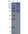 page-flp120511 dcstamp strep sp1