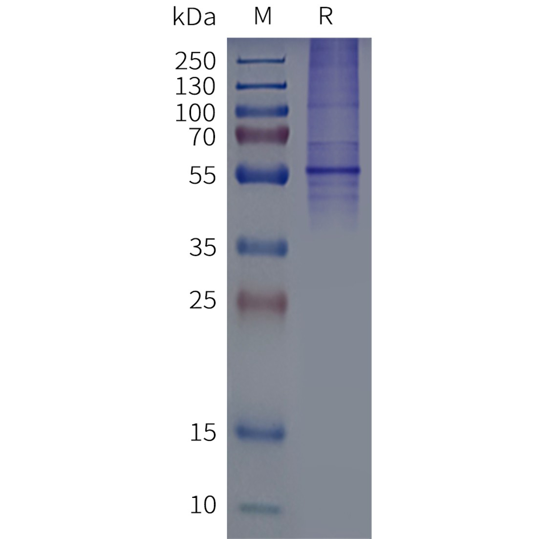 flp120511-dcstamp-strep-sp1.png