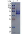 page-flp120514 reachr strep sp1