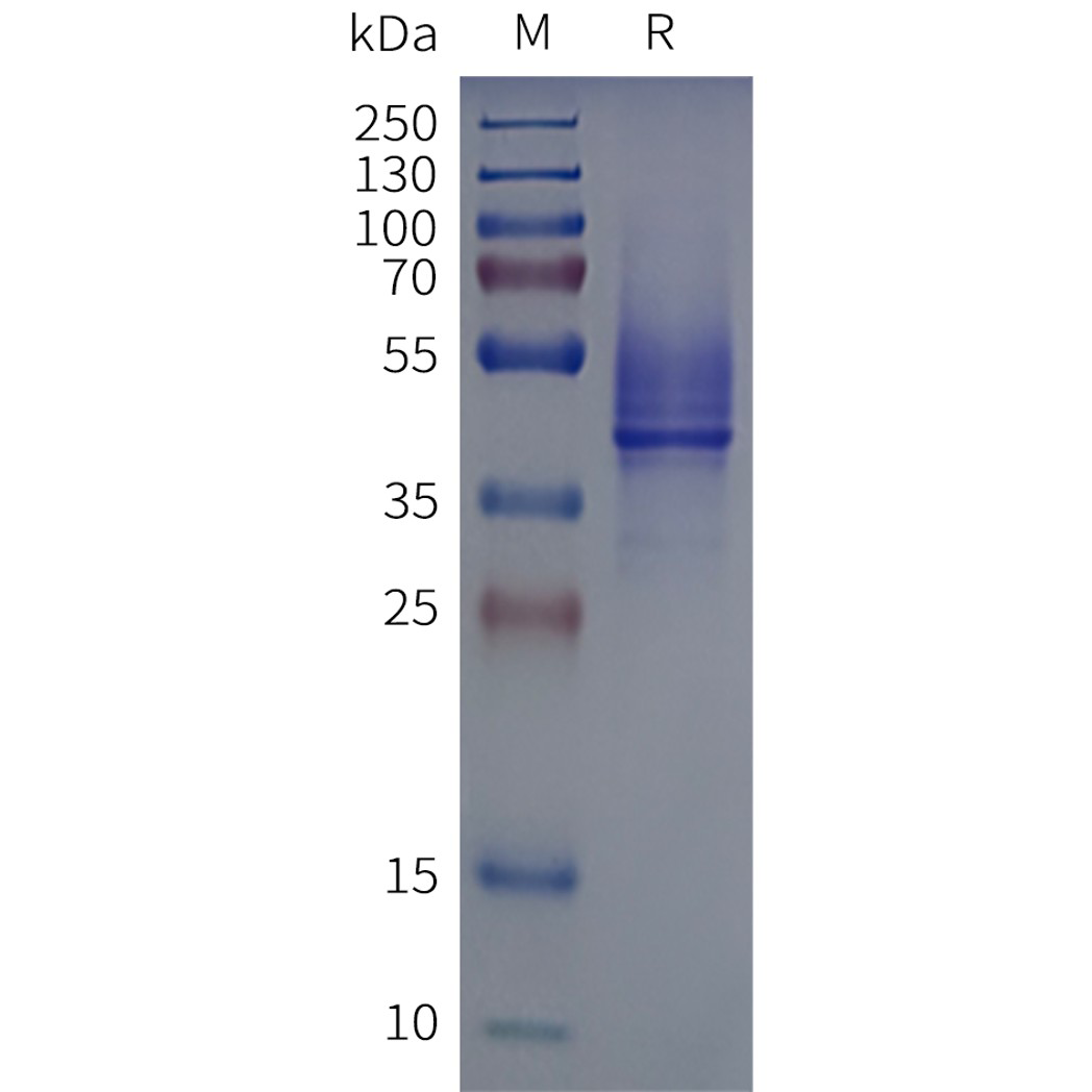 flp120514-reachr-strep-sp1.png