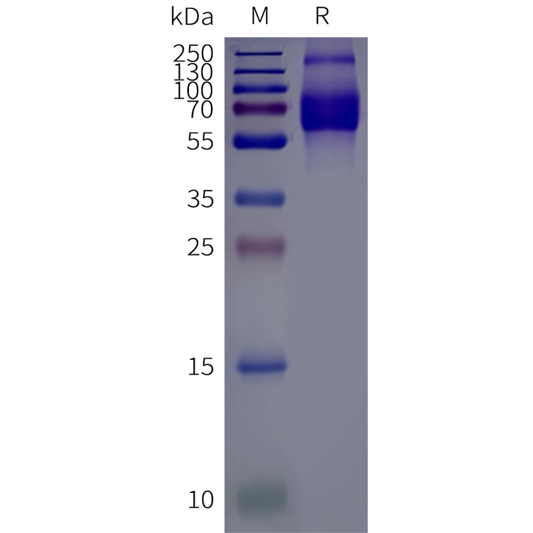 flp120515-flvcr1-strep-sp1.png