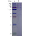 page-flp120516 or2t12 strep sp1