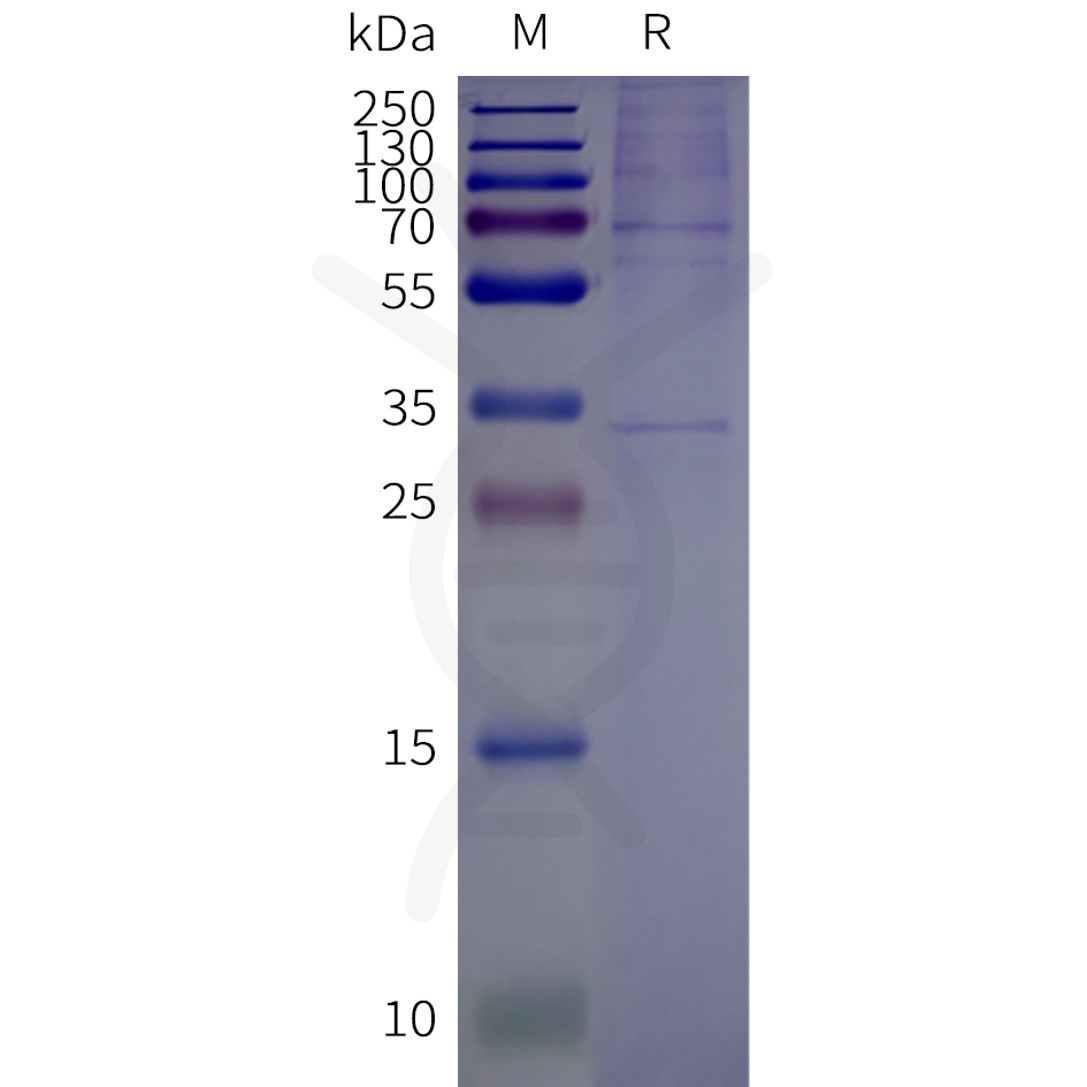 flp120516-or2t12-strep-sp1.png