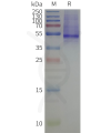 page-flp120517 kcnj1 strep sp1