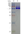 page-flp120518 kcnj3 strep sp1