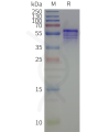 page-flp120519 kcnj4 strep sp1