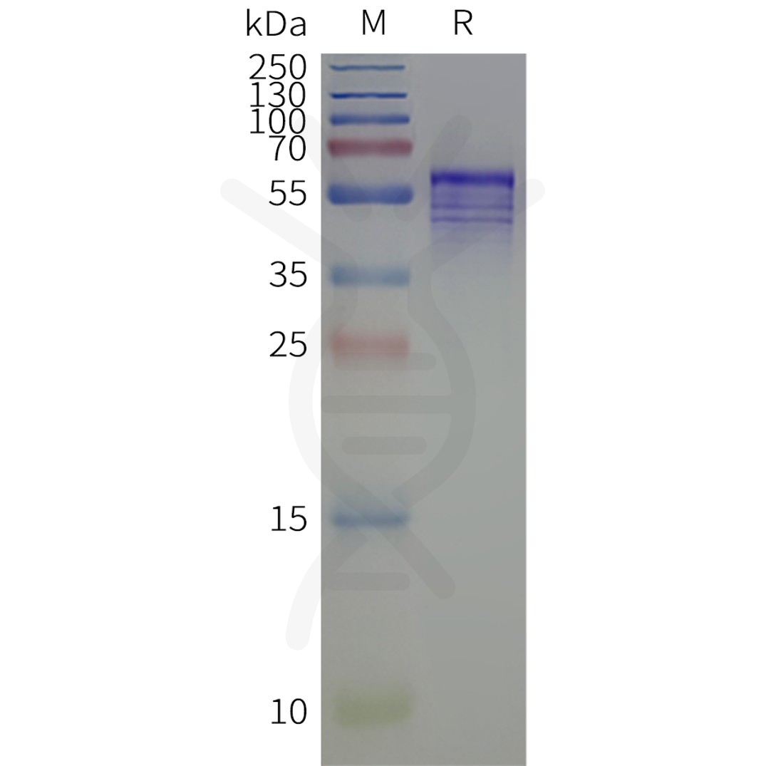 flp120519-kcnj4-strep-sp1.png