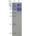 page-flp120520 kcnj13 strep sp1
