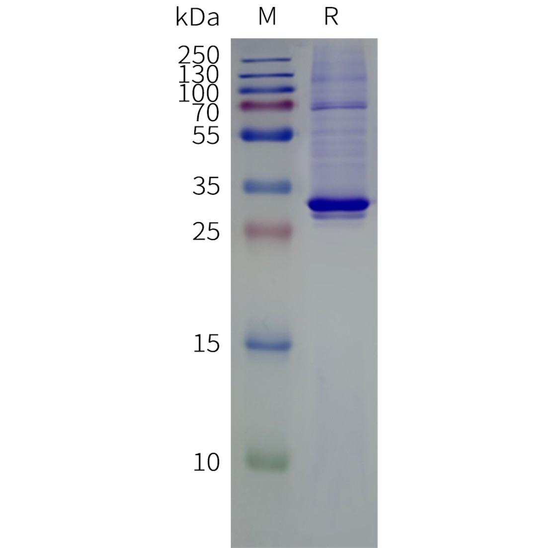 flp120649-vdac3-strep-sp1.png