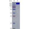 page-flp120661 abcc4 strep sp1
