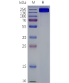 page-flp120661 abcc4 strep sp1
