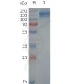 page-flp120759 trpc6 strep sp1