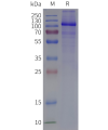page-flp120839 gria1 strep sp1