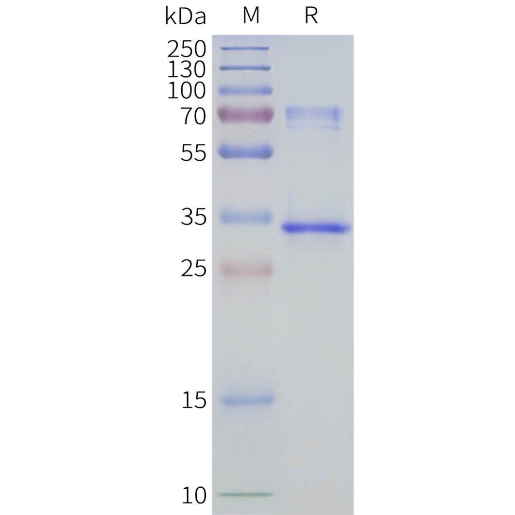flp400504-aqp4-m1-sp1.png