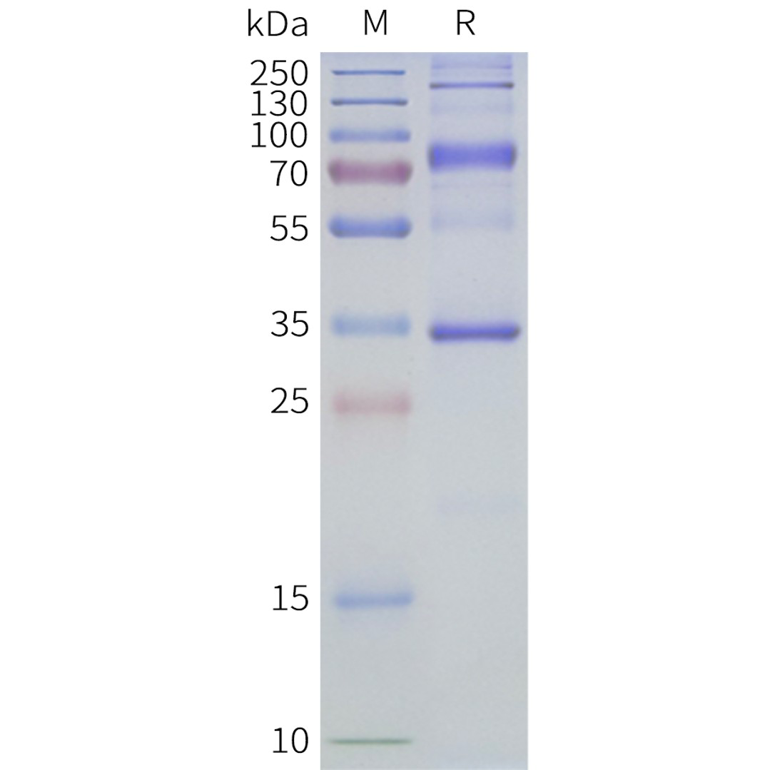flp400509-aqp4-m23-sp1.png