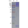 page-flp420045 tshr strep sp1
