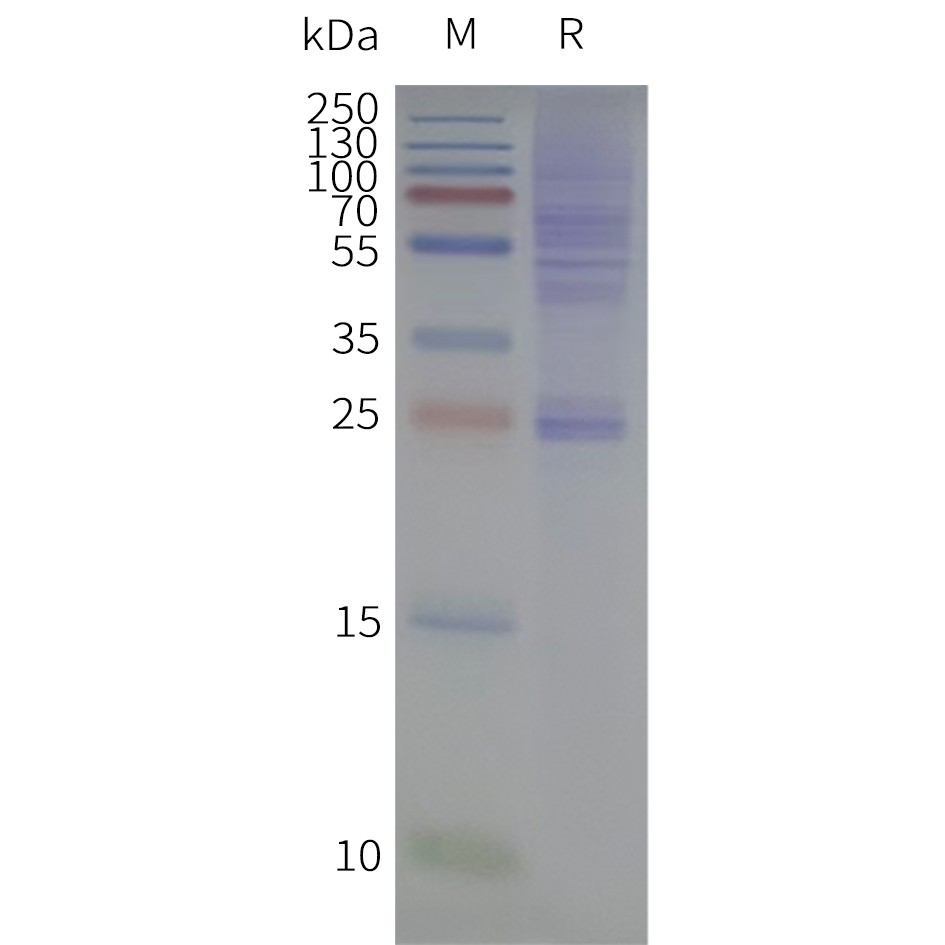 flp420503-cldn18.1-strep-sp1.jpg