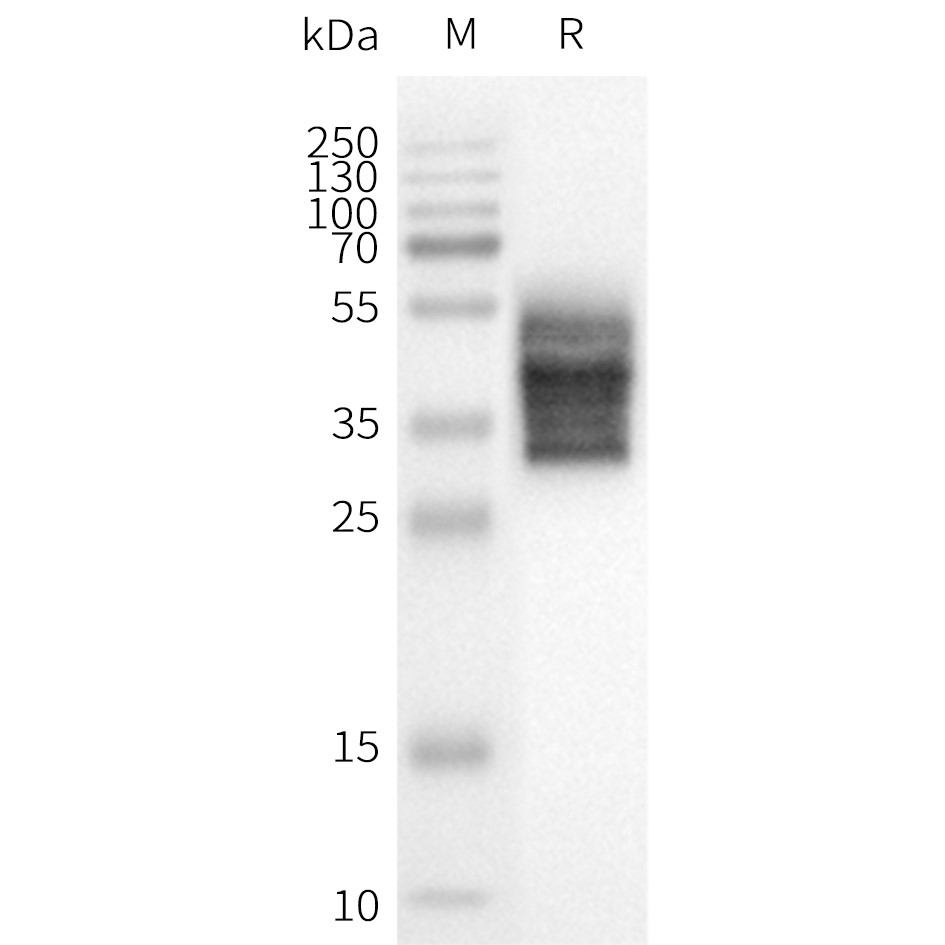 flp100116-gpr132-wb1.png