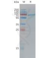 sp-PME C100012 ADAM9 Fig.1 SDS PAGE 1