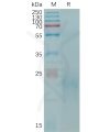 sp-PME C100013 CLEC4C Fig.1 SDS PAGE 1