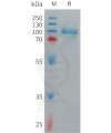 sp-PME C100014 CD93 Fig.1 SDS PAGE 1