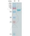 sp-PME C100017 ALPP Fig.1 SDS PAGE 1