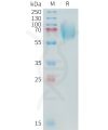 sp-PME C100018 B7 H3 Fig.1 SDS PAGE 1