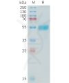 sp-PME C100019 TNFSF15 Fig.1 SDS PAGE 1