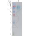 sp-PME C100020 5T4 Fig.1 SDS PAGE 1