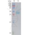 sp-PME C100021 PD L1 Fig.1 SDS PAGE 1
