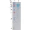 sp-PME C100022 GUCY2C Fig.1 SDS PAGE 1