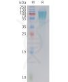 sp-PME C100022 GUCY2C Fig.1 SDS PAGE 1