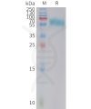 sp-PME C100023 4 1BB Fig.1 SDS PAGE 1