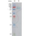 sp-PME C100025 AXL Fig.1 SDS PAGE 1