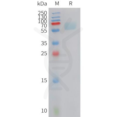 sp-PME C100025 AXL Fig.1 SDS PAGE 1