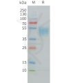 sp-PME C100028 CD24 Fig.1 SDS PAGE 1