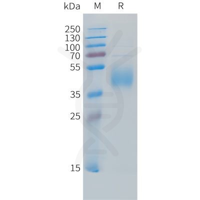 sp-PME C100031 B7 H6 Fig.1 SDS PAGE 1