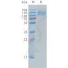 sp-PME C100033 CEACAM5 Fig.1 SDS PAGE 1
