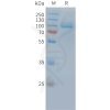 sp-PME C100035 PSMA Fig.1 SDS PAGE 1