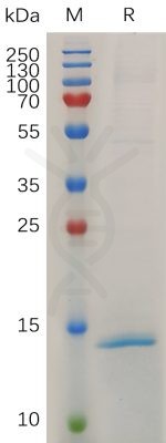 sp-PME M100032 RNASE4 His PAGE 300