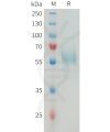 sp-PME M100080 TREM2 Fig.1 SDS PAGE 1