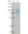 sp-PME M100082 ICAM1 Fig.1 SDS PAGE 1