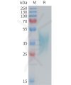 sp-PME M100086 TNFRSF1B Fig.1 SDS PAGE 1