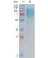 sp-PME M100087 GUCY2C Fig.1 SDS PAGE 1