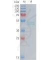 sp-PME M100088 IL11RA Fig.1 SDS PAGE 1