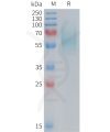 sp-PME M100089 5T4 Fig.1 SDS PAGE 1