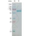 sp-PME M100092 AFP Fig.1 SDS PAGE 1