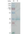 sp-PME M100093 CGRP Fig.1 SDS PAGE 1