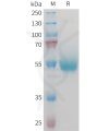 sp-PME M100095 CD70 Fig.1 SDS PAGE 1