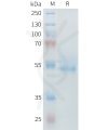 sp-PME M100097 ROR2 Fig.1 SDS PAGE 1